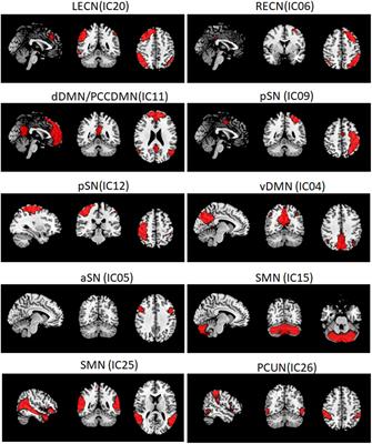 Networks Are Associated With Depression in Patients With Parkinson’s Disease: A Resting-State Imaging Study